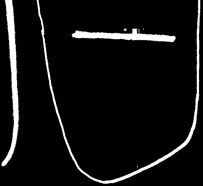 Skissene til venstre syner prinsipp for korleis ein kan dele inn kvart av nivåa i tomter med ulike storleikar.