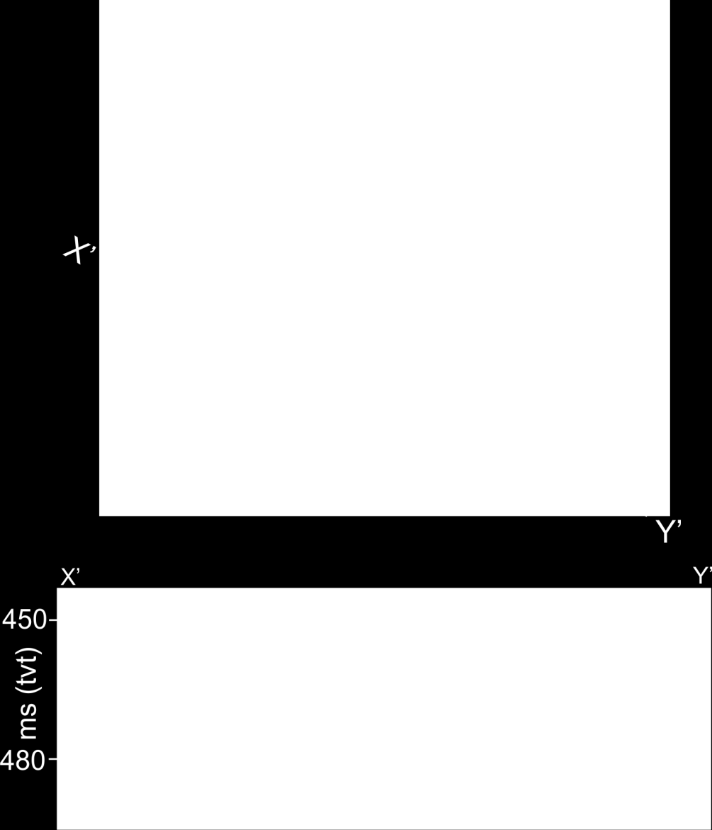 Reflektor RE2A Den genererte flaten av reflektor RE2A preges av tilnærmet lineære furer, krumlinjeformede furer og noen få sirkulære forsenkninger (Fig. 4.18a).