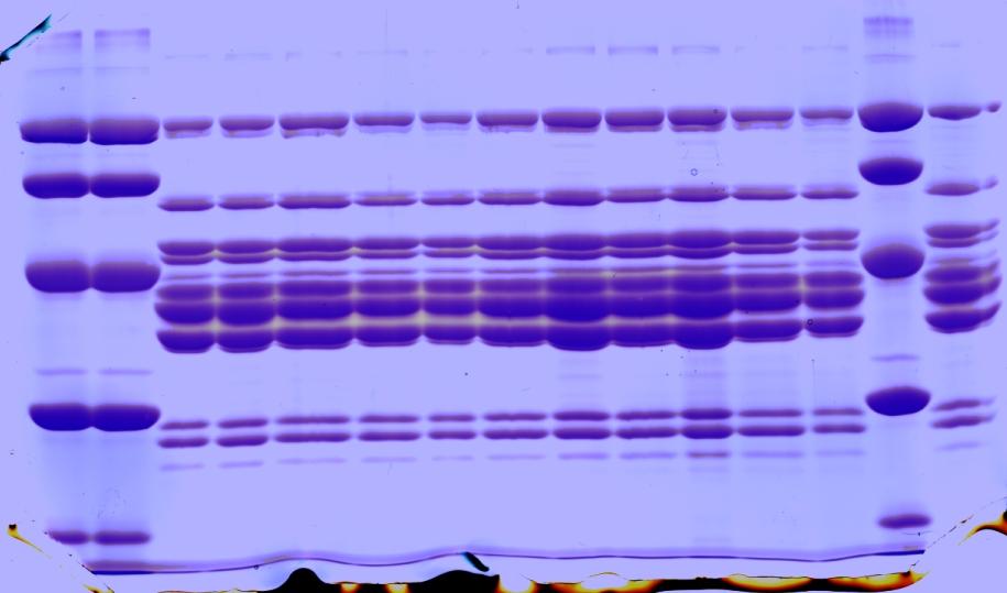 Immunodeteksjon av