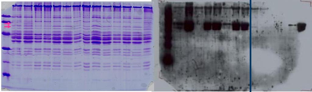 Immunodeteksjon av ubiquitin-ubiquitinated proteiner 3B 4B 5A 5B 8B 9B 10A 10B 3C 4C 5C