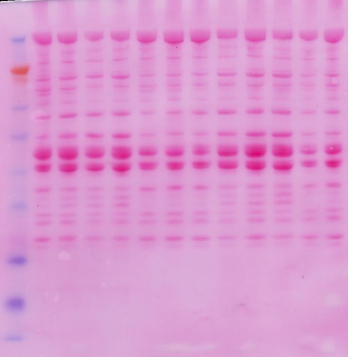 Immunodeteksjon av α-aktinin, aktin og MHC Std