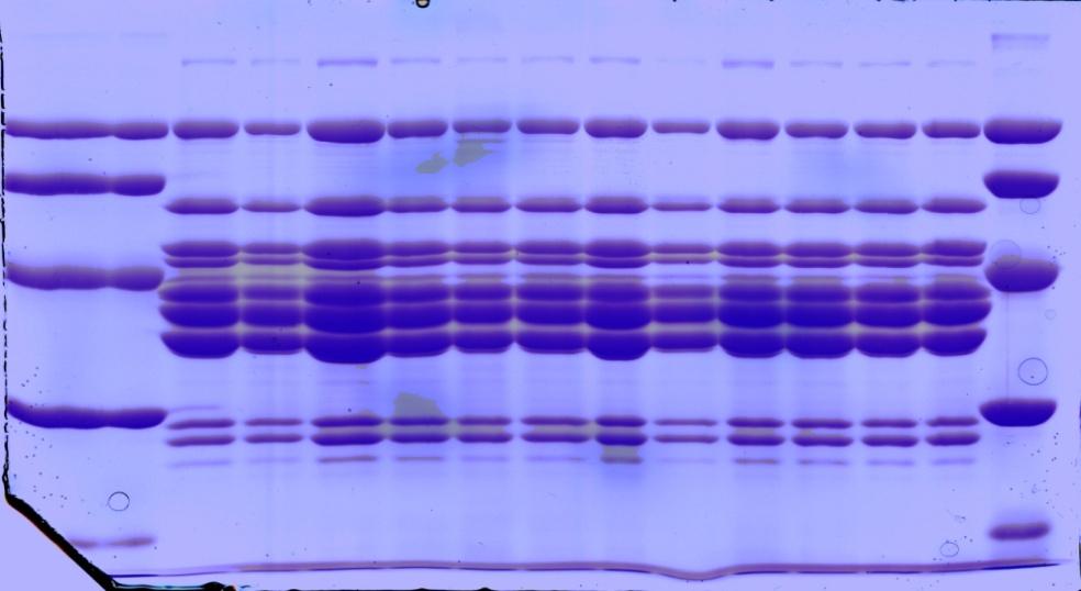 Immunodeteksjon av 50 kda red