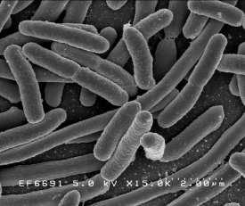 Bakterier Virus DLL Antropogene kilder Forbrenning av