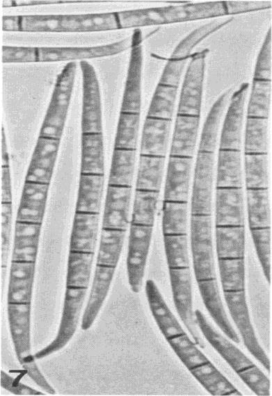 (1994) beskriver i sin oversiktsartikkel, er det tre typer sporer som Fusariumarter kan produsere, og disse kalles makrokonidia, mikrokonidia og klamydosporer.