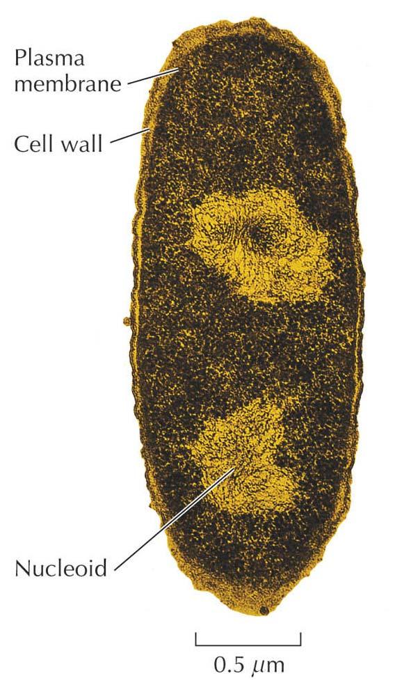 Prokaryote celler Prokaryote celler deles inn i archaebakterier og eubakterier.