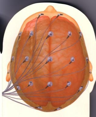 EEG - normal