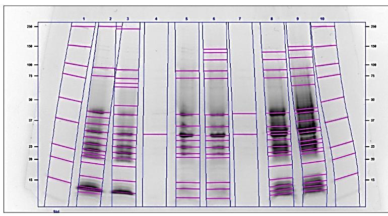 Figur 12: SDS-PAGE isolat RK-9100. To parallellbrønner for hvert medium. STD: Precision Plus Protein TM WesternC Standards.
