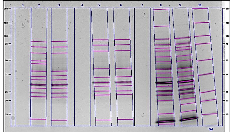 BA 2% NaCl CO 2 BA 2% NaCl Luft CHAB STD Figur 13: SDS-PAGE isolat RK-9100.