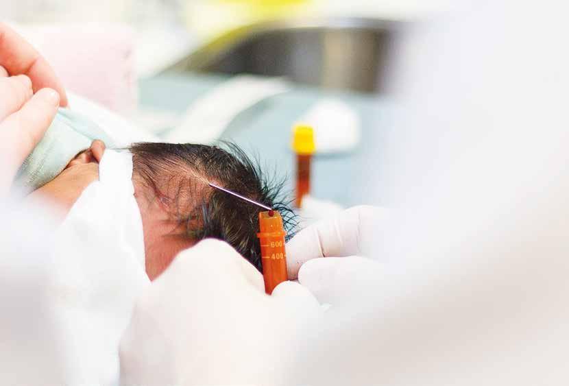En baby ved nyfødtintensiven i Haugesund får tatt blodprøve fra en vene i hodet. må overkommes, fastslår Misje og Børø.