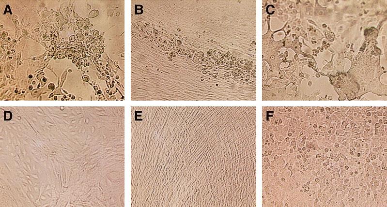 Cytopatogen effekt av virusinfeksjon A = Herpes simplex virus infiserte primære kanin nyreceller, D = uinfiserte celler B = Cytomegalovirus