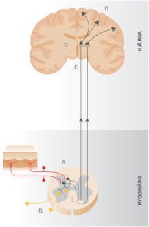 Pain Terms: A Current List with Definitions and Notes on Usage. Part II. 1979;Pain 6:249-52.