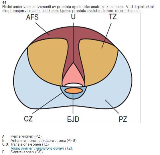 Spørsmål 44 (urologi) Fasit (Transisjons-sonen - TZ) er feil. Riktig svar er Perifersonen (PZ).