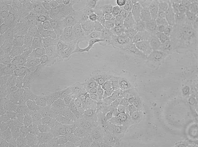 Tabell 2.1. Hoved egenskaper til BxPC3-cellene Kliniske data Kvinne, 61 år, adenokarsinom i bukspyttkjertel Morfologien Epiteliale celler Vekst egenskaper Adherente Evne til å indusere tumorvekst Ja.