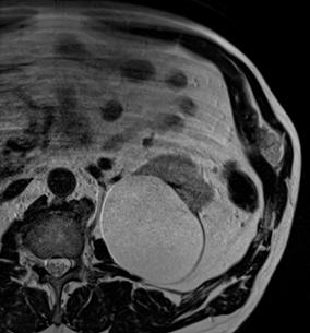 4 Bruken av poliklinisk bildediagnostikk Bildediagnostikk er en samlebetegnelse for medisinsk diagnostisering ved at det tas bilder av kroppen.