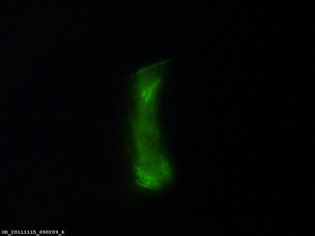 Viser konjunktival staining (strek).