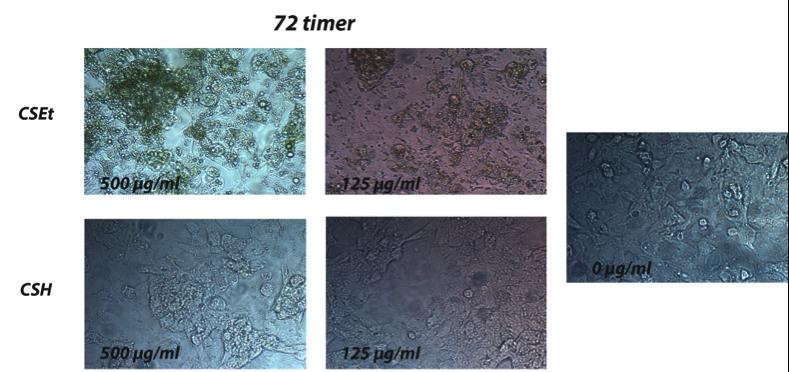 Figur 4.6.1. Viser lysmikroskopbilder av Hep G2 celler etter 24, 48 og 72 timer stimulering med CSEt og CSH.