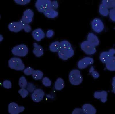 Immunhistokjemi Pålitelig og enkel deteksjon med FISH- og CISH-metoder FISH og CISH i høy kvalitet ViewRNA til spesifikk påvisning av mrna ViewRNA in situ