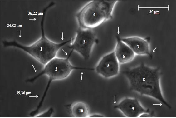 Materialer og metoder A B Celleantall Antall celler med nevritter Antall nevritter per celle Antall lange nevritter Nevrittlengde per celle 10 7/10 12/10 3/12 (36,22 μm + 24,82 μm + 39,36 μm)/10