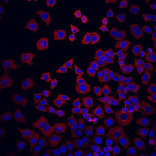 fikseringen. A B C D Figur 3.18 Immunfarging med anti-β-tubulin III. Eksponering av PC12-celler. (A) Ubehandlede PC12-celler.