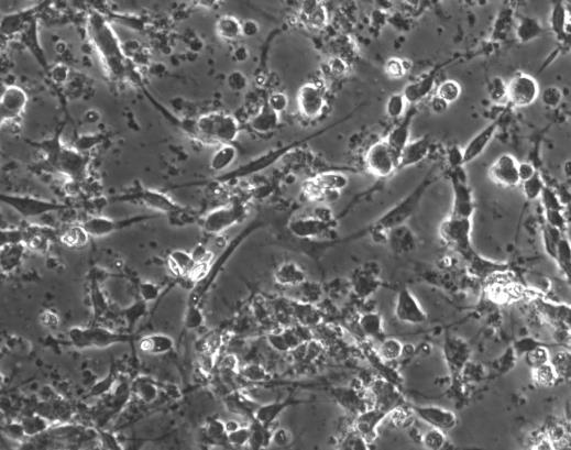 Resultater 3.5 Nevrittutvekst i korncellekulturer PC12-celler er ikke nevroner, men kreftceller som har en rekke egenskaper som ligner det man ser i sympatiske nevroner [53].