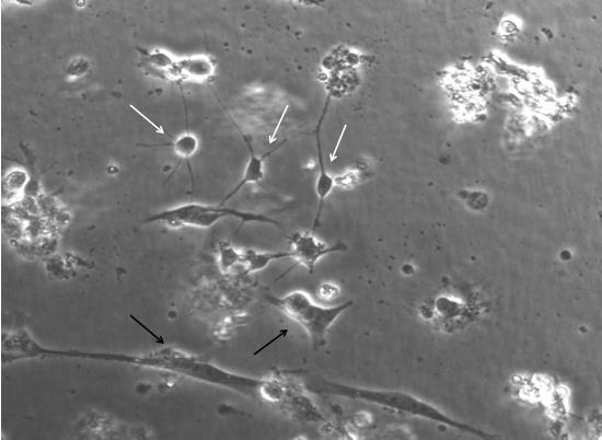 1 Kornceller fra lillehjerne hos kylling Kornceller ble platet ut på to ulike tettheter, 1,7 10 6 og 8,5 10 5 celler/ml, og mikroskopert 24 timer etter utplating.