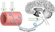 sentrale smerteførende baner i hjernen via binding til 5-HT1D-reseptoren i trigeminuskjernen i hjernestammen [63, 64]. Figur 1.2.1: Bildet viser de ulike angrepspunktene for Triptaner.