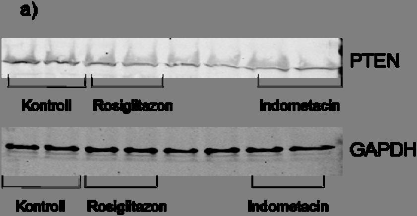 64 Figur 16: Effekt av rosiglitazon (10µM) og indometacin (100µM) på ekspresjon av PTEN målt ved Western blotting, i HT 29 celler (n=3). Cellene ble sådd ut med en celletetthet på 50 000 celler/cm 2.