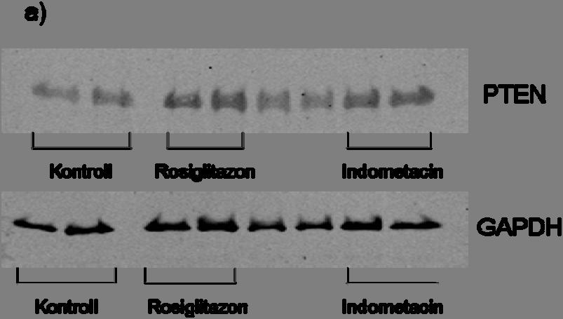 65 Figur 17: Effekt av rosiglitazon (10µM) og indometacin (100µM) på ekspresjon av PTEN målt ved Western blotting, i HCT 116 celler (n=4).