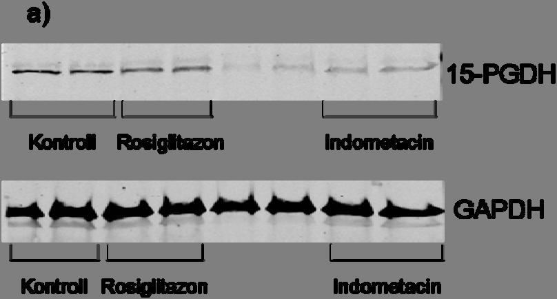 69 Figur 20: Effekt av rosiglitazon (10µM) og indometacin (100µM) på ekspresjon av 15-PGDH målt ved Western blotting, i HCT 116 celler (n=4).