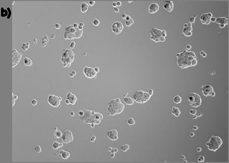 b) Celler stimulert med 10 µm rosiglitazon.