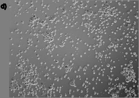 d) Celler stimulert med 100 µm sulindaksulfid.