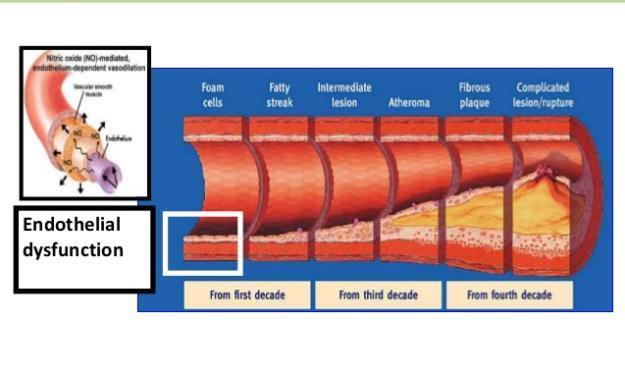 Mikroalbuminuri endotelial dysfunksjon Mikroalbuminuri CRP Tsioufis et al Am J Cardiol 2005;96 (7) ADMA Asymmetric dimethylarginine Yilmaz et al JASN; 2008 (19)