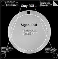 Figur 1: Plassering av ROI signal og ROI bakgrunn i fantombilde.