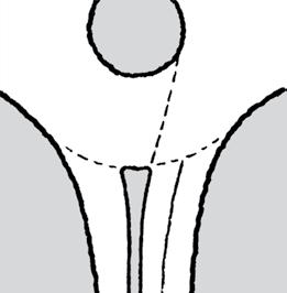 80 Parallelldeleøy i tilfarten utformes som et rektangel og symmetrisk om vegarmens senterlinje.