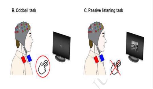 mevirkende ved kronisk tinnitus (Mirz et al,