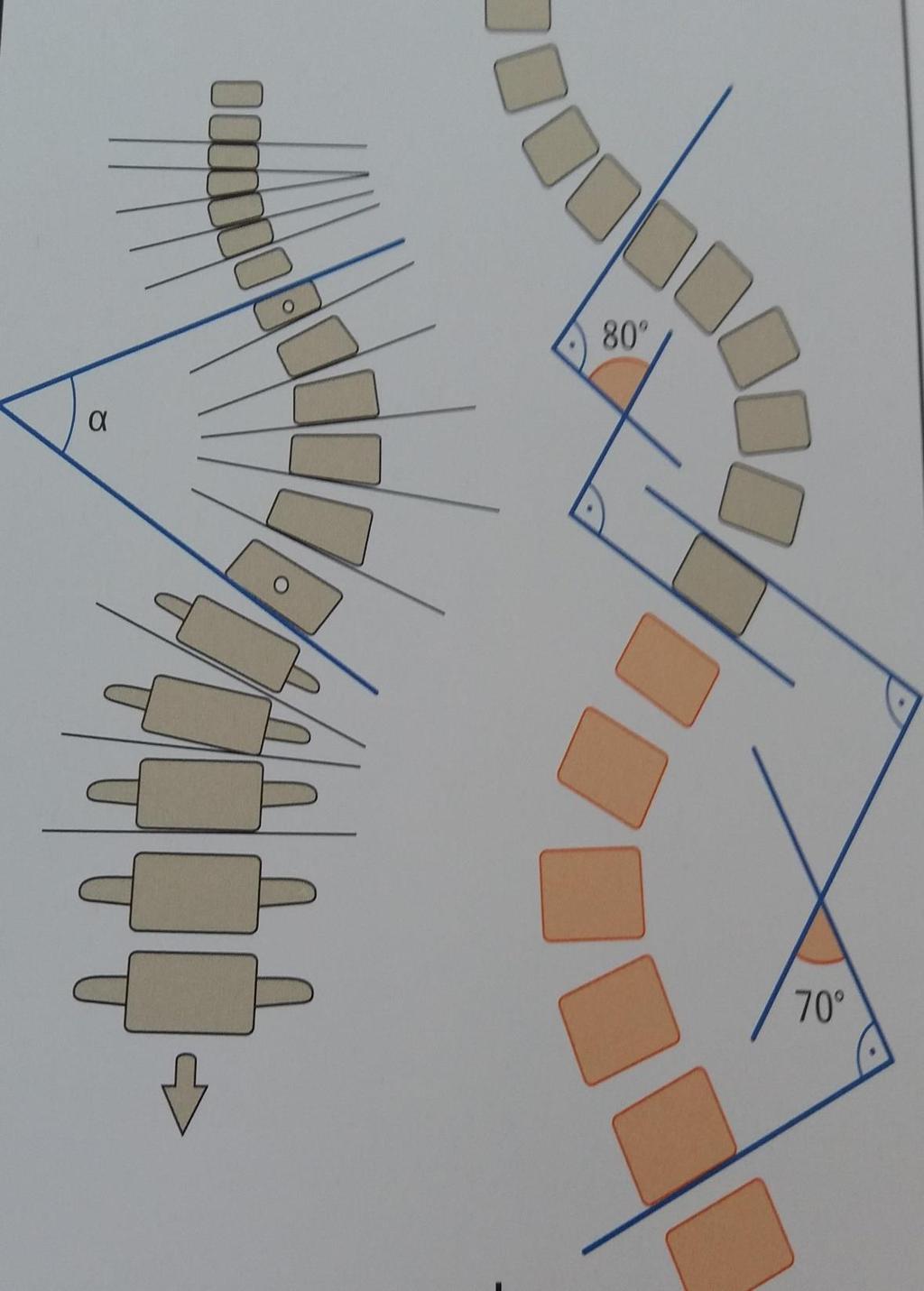 Skoliose. Måling av «Cobb s vinkel».