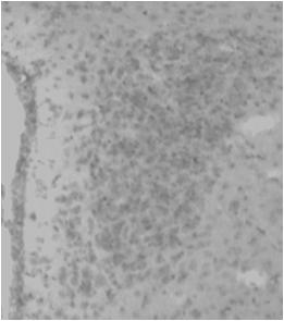 Neurohypofysen Paraventricular Supraoptic hypothalamus