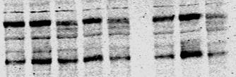 proteinbåndet for prolegumain (56 kda) som i kontrollcellene (Fig. 4.1B, brønn 2 vs. brønn 1 og 6), mens blottet viste sterkere intensitet i båndet for modent legumain (36 kda; brønn 2).