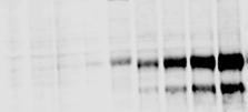 og 10 µm; Figur 4.6). Dette ble observert som økende intensitet i proteinbånd for både legumain (brønn 6-9; andre panel), MP-L01 (tredje panel) og samlokalisering (gult, øverste panel).