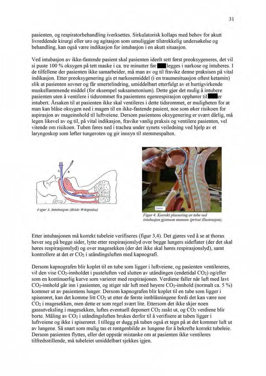 31 pasienten, og respiratorbehandling iverksettes.