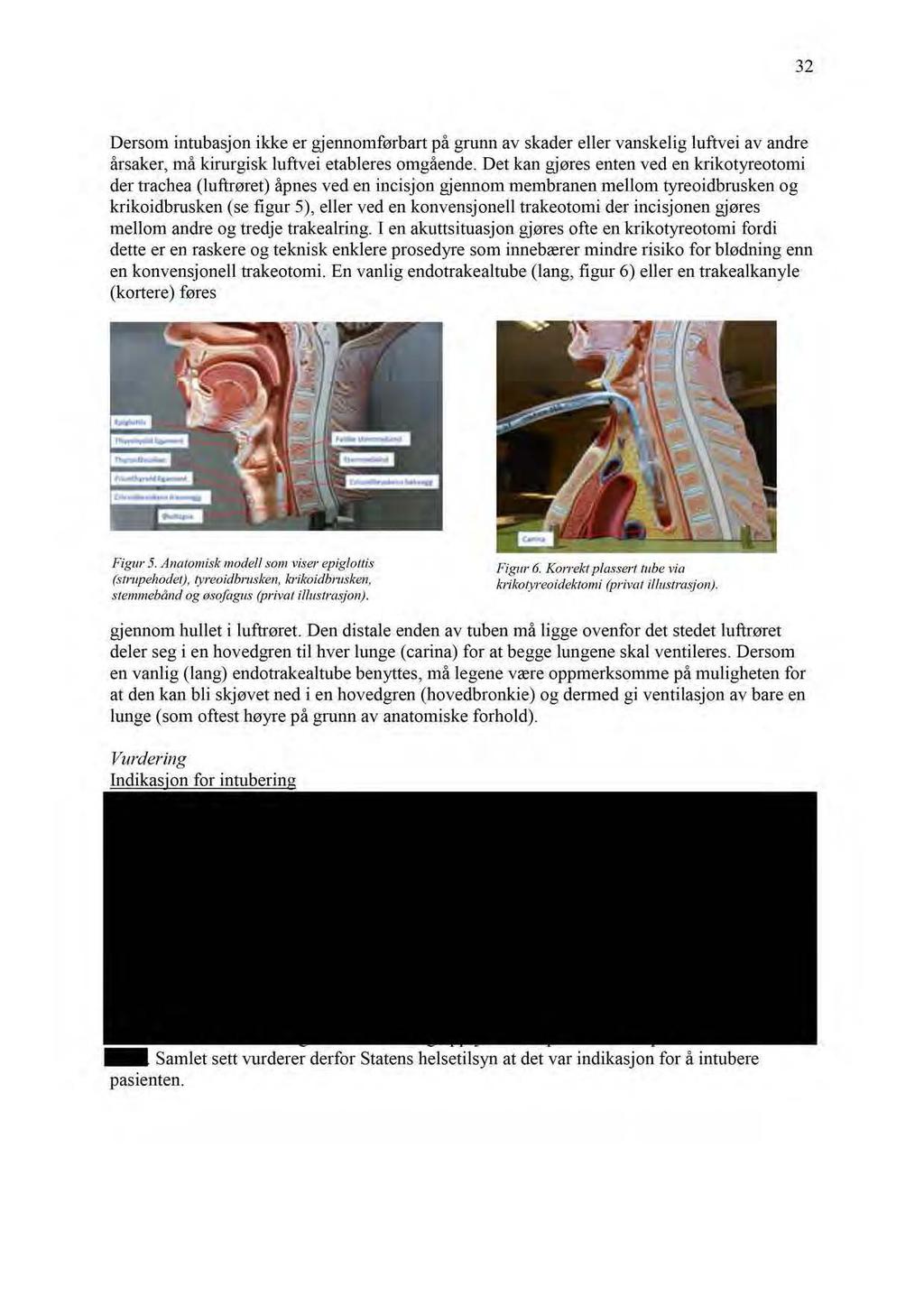 32 Dersom intubasjon ikke er gjennomførbart på grunn av skader eller vanskelig luftvei av andre årsaker, må kirurgisk luftvei etableres omgående.