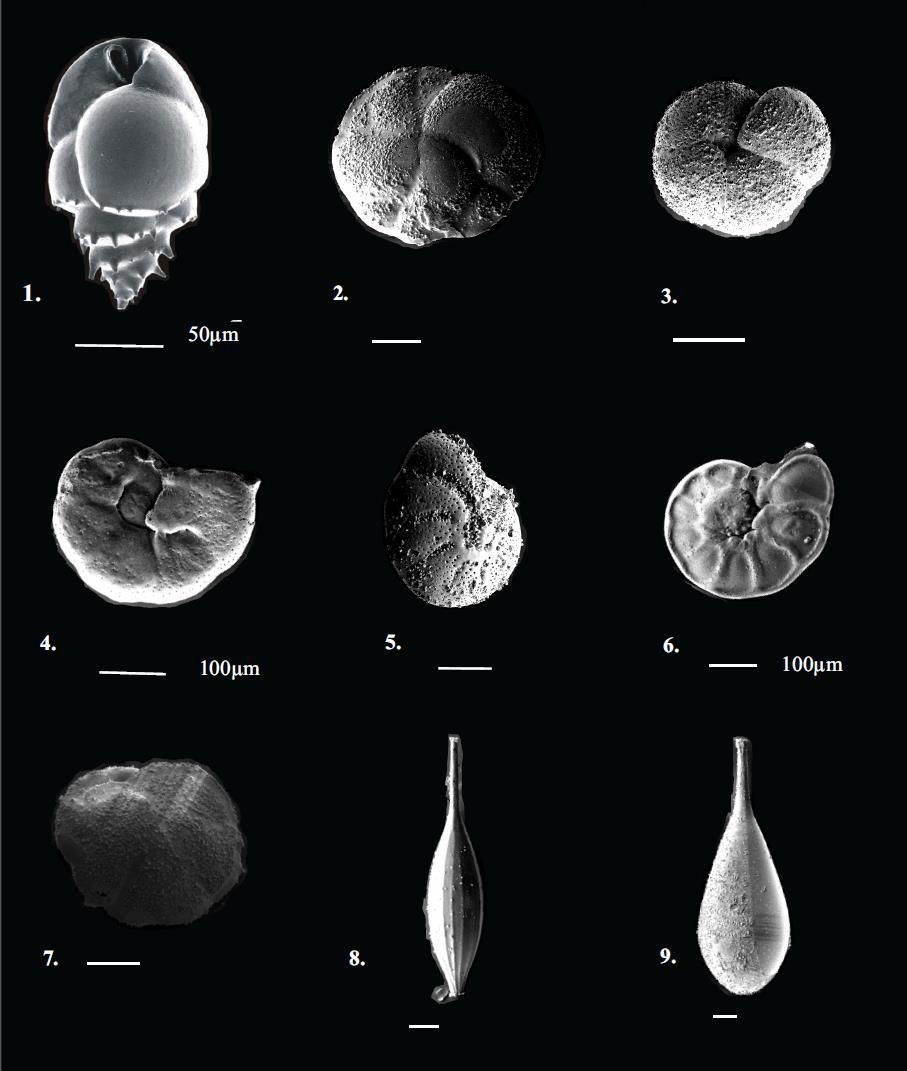 Appendiks B B. Plansjer PLANSJE 1 SEM bilder av de vanligste og mest karakteristiske bentiske foraminiferaen i kjerne GS12-172- 04PC. Skalen er 50 µm hvis ikke annet er oppgitt. 1. Bulimina marginata (d Orbigny) 2.