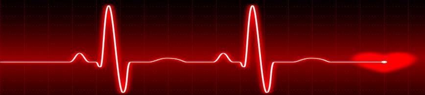 Kondisjon og hjerte-karsykdom Veletablert sammenheng mellom kondisjon og hjerte-karsykdom