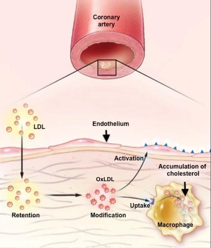 LDL (low density lipoprotein) er en type lipoprotein som består av fosfolipider, kolesterolestere, triglyserider samt fritt kolesterol [8].