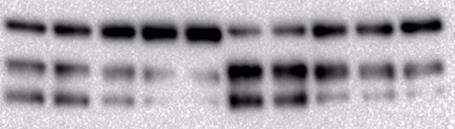 Resultater A Kolkisin (µm) Kolkisin-valin (µm) 0 0,01 0,025 0,05 0,5 - - - - - - - - - - 0 0,1 0,5 1 10 kda 56 Anti-legumain 46/47 36 Anti-GAPDH 37 B Kolkisin (µm) Kolkisin-prodrug (µm) 0-0,01 0,05