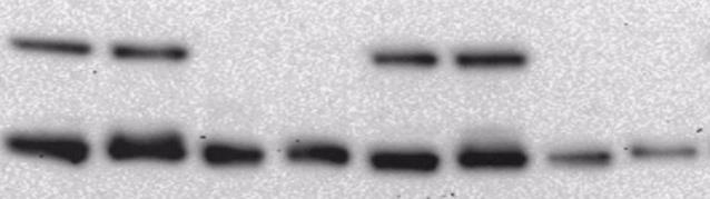 Resultater Cellelysatene fra både celleforsøket og cellelysatforsøket ble videre brukt til immunoblotting for å undersøke hva nedgangen i legumainaktivitet kunne skyldes.