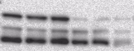 Av ukjente grunner ble det ikke detektert noen bånd i fremkallingen (figur ikke vist). Deretter ble deteksjon med antistoff mot biotin forsøkt, men også dette uten resultat.