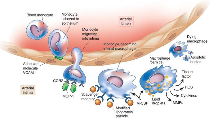 Endotel Inflammasjon Invasjon av monocytter i