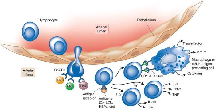 Endotel Inflammasjon Invasjon av T-celler i aterosklerotiske