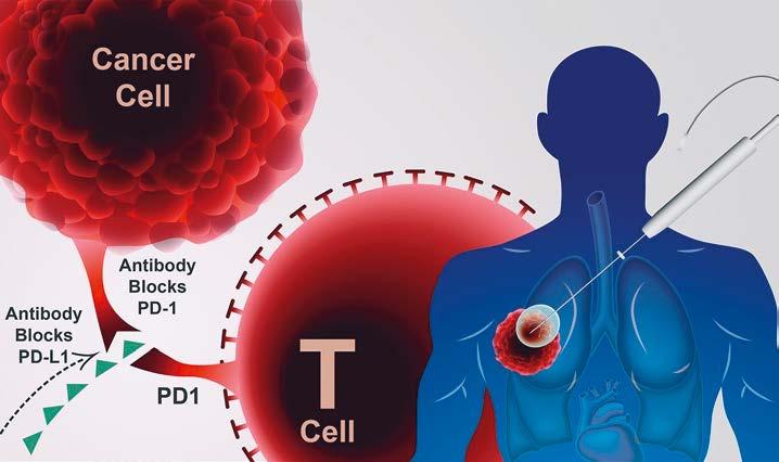 LUNGEKREFTKONFERANSEN 2017 BIOMARKØRER FOR IMMUNTERAPI STORMØTE om lungekreft 27. mars 2017 Thon Hotel Opera, Oslo 09.30: Registrering og enkel servering 10.